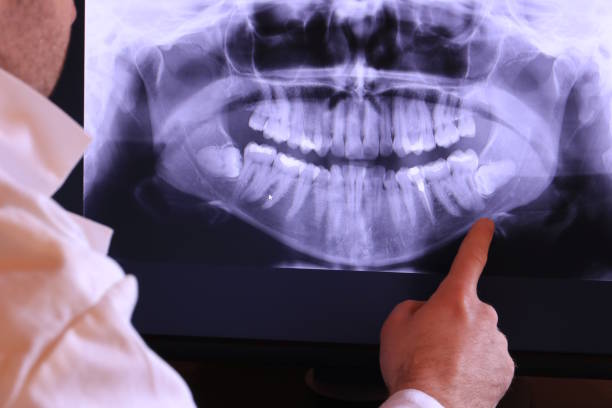 Best Emergency TMJ Treatment in Riverdale, CA