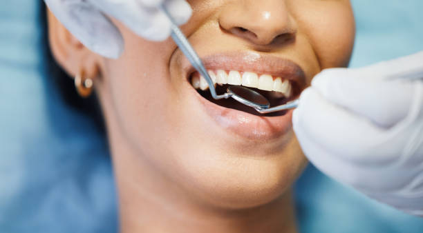 Best Emergency Treatment for Dental Infections or Abscesses in Riverdale, CA