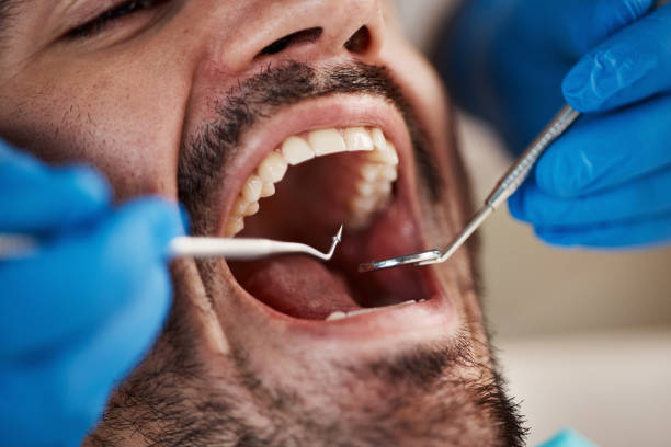 Best Emergency Treatment for Dental Infections or Abscesses in Riverdale, CA